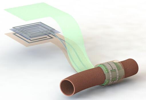 上圖描繪了這款可生物降解的壓力傳感器，它圍繞著一根血管，天線在左側(cè)(分離的層狀結(jié)構(gòu)，展示了天線結(jié)構(gòu)的細節(jié))